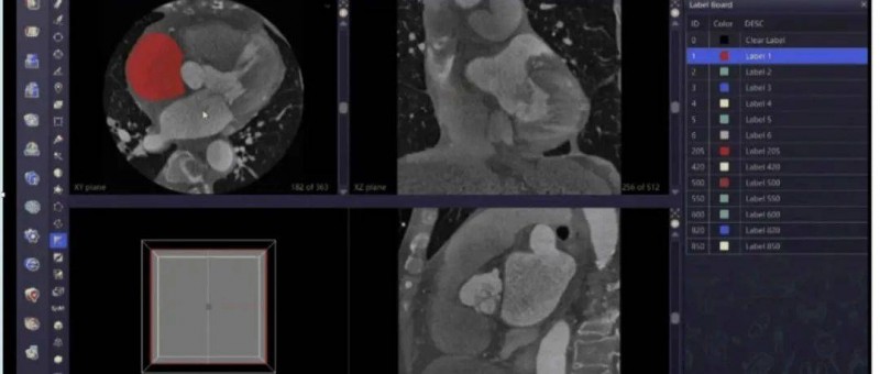 產(chǎn)品經(jīng)理，這個行業(yè)值得投簡歷！
